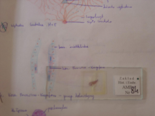84) komorki browicza kupfera